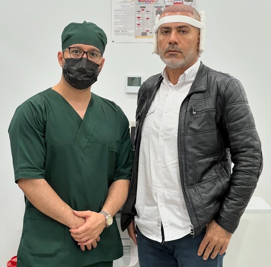 hair transplant